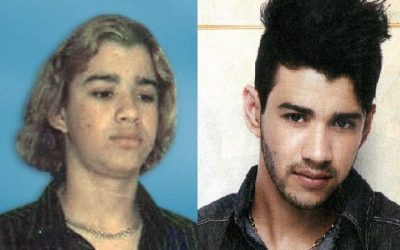 famosos que usaram minoxidil