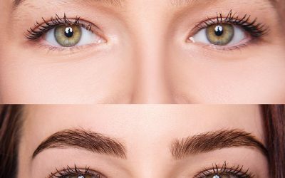 Minoxidil para Sobrancelha: Como Usar, Resultados e Dicas Essenciais minoxidil para sobrancelhas